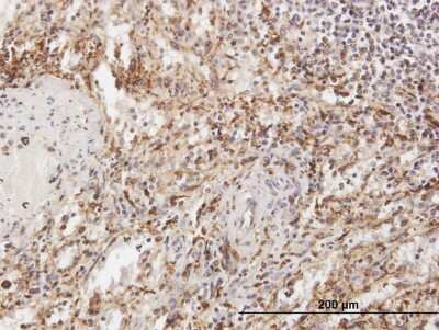 Immunohistochemistry-Paraffin: Tripeptidyl-Peptidase I/TPP1 Antibody [H00001200-B01P] - Analysis of purified antibody to TPP1 on formalin-fixed paraffin-embedded human spleen. (antibody concentration 3 ug/ml)
