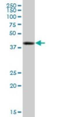 Western Blot: Tripeptidyl-Peptidase I/TPP1 Antibody [H00001200-B01P] - Analysis of TPP1 expression in human spleen.