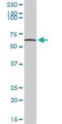 Western Blot: Tripeptidyl-Peptidase I/TPP1 Antibody [H00001200-D01P] - Analysis of TPP1 expression in human placenta.