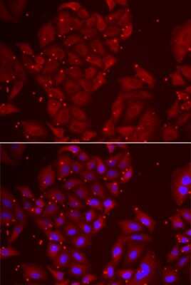 Immunocytochemistry/ Immunofluorescence Tripeptidyl peptidase II Antibody - BSA Free
