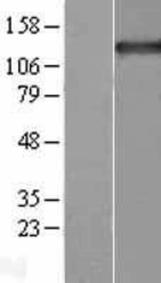Western Blot Tripeptidyl peptidase II Overexpression Lysate