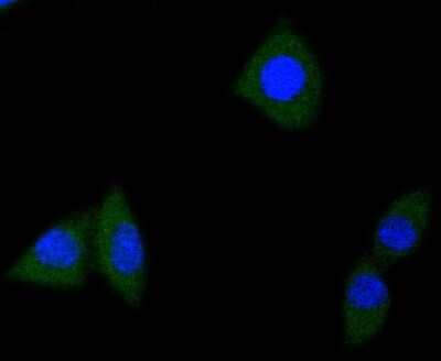 Immunocytochemistry/Immunofluorescence: TrkA Antibody (JJ084-04) [NBP2-67841] - Staining TrkA+B+C in SH-SY-5Y cells (green). The nuclear counter stain is DAPI (blue). Cells were fixed in paraformaldehyde, permeabilised with 0.25% Triton X100/PBS.