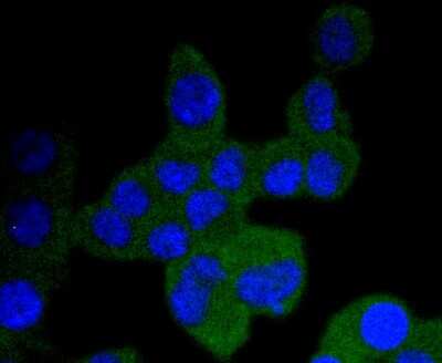 Immunocytochemistry/Immunofluorescence: TrkA Antibody (JJ084-04) [NBP2-67841] - Staining TrkA+B+C in N2A cells (green). The nuclear counter stain is DAPI (blue). Cells were fixed in paraformaldehyde, permeabilised with 0.25% Triton X100/PBS.