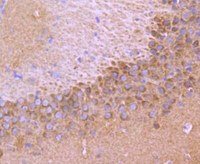Immunohistochemistry-Paraffin: TrkA Antibody (JJ084-04) [NBP2-67841] - Analysis of paraffin-embedded mouse brain tissue using anti-TrkA+B+C antibody. Counter stained with hematoxylin.
