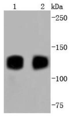 Western Blot: TrkA Antibody (JJ084-04) [NBP2-67841] - Analysis of TrkA+B+C on different lysates using anti-TrkA+B+C antibody at 1/1,000 dilution. Positive control: Lane 1: Rat brain Lane 2: Mouse brain