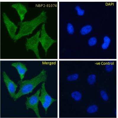 Immunocytochemistry/Immunofluorescence: TrkA Antibody (MNAC13) [NBP2-81074] - Immunofluoresence staining of fixed HeLa cells with anti-TrkA antibody (MNAC13) [NBP2-81074]. Immunofluorescence analysis of paraformaldehyde fixed HeLa cells, permeabilized with 0.15% Triton stained with the chimeric rabbit IgG version of MNAC13 [NBP2-81074] at 10 ug/ml for 1h followed by Alexa Fluor 488 secondary antibody (1 ug/ml), showing cytoplasmic staining. The nuclear stain is DAPI (blue). Panels show from left-right, top-bottom NBP2-81074, DAPI, merged channels and a negative control. The negative control was stained with unimmunized rabbit IgG followed by Alexa Fluor 488 secondary antibody.