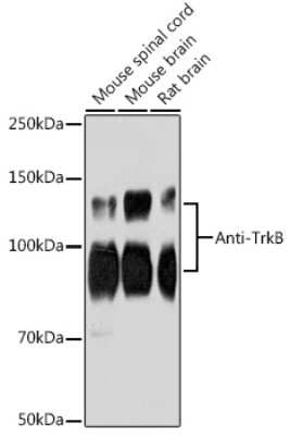 Western Blot: TrkB Antibody (1D7U4) [NBP3-15948] - Western blot analysis of extracts of various cell lines, using TrkB antibody (NBP3-15948) at 1:1000 dilution. Secondary antibody: HRP Goat Anti-Rabbit IgG (H+L) at 1:10000 dilution. Lysates/proteins: 25ug per lane. Blocking buffer: 3% nonfat dry milk in TBST. Detection: ECL Enhanced Kit. Exposure time: 180s.