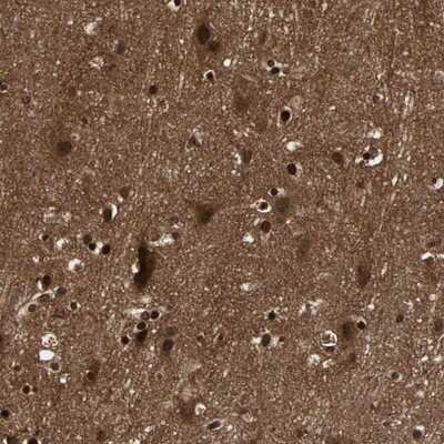 Immunohistochemistry-Paraffin: TrkB Antibody [NBP1-86903] - Staining of human cerebral cortex shows strong nuclear and cytoplasmic positivity in neuronal cells and strong nuclear positivity in glial cells.