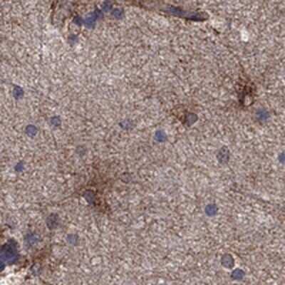 Immunohistochemistry-Paraffin: TrkB Antibody [NBP3-16988] - Staining of human hippocampus shows cytoplasmic positivity in glial cells.