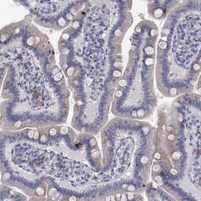 Immunohistochemistry-Paraffin: TrkB Antibody [NBP3-16988] - Staining of human small intestine shows low expression as expected.