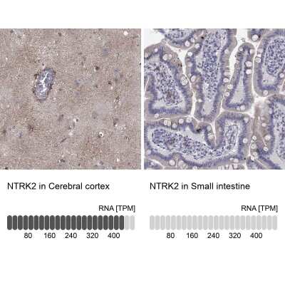 Immunohistochemistry-Paraffin: TrkB Antibody [NBP3-16988] - Analysis in human cerebral cortex and small intestine tissues using Anti-NTRK2 antibody. Corresponding NTRK2 RNA-seq data are presented for the same tissues.