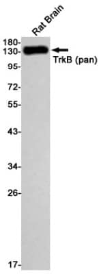 Western Blot: TrkB Antibody (S01-8H1) [NBP3-19481] - Western blot detection of TrkB (pan) in Rat Brain cell using TrkB (pan) Rabbit mAb (1:1000 diluted). Predicted band size: 92kDa. Observed band size: 120-140kDa.