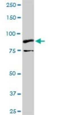 Western Blot: TrkB Antibody [H00004915-D01P] - Analysis of NTRK2 expression in human stomach.