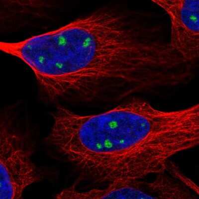 Immunocytochemistry/Immunofluorescence: TrkC Antibody [NBP2-55927] - Staining of human cell line U-2 OS shows localization to nucleoli.