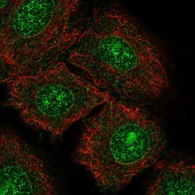 Immunocytochemistry/Immunofluorescence: TrkC Antibody [NBP2-58383] - Staining of human cell line A549 shows localization to nucleoli & nuclear membrane.