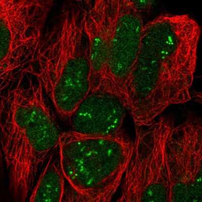 Immunocytochemistry/Immunofluorescence: Trophinin Antibody [NBP2-58739] - Staining of human cell line HEK 293 shows localization to nucleus & nucleoli fibrillar center.