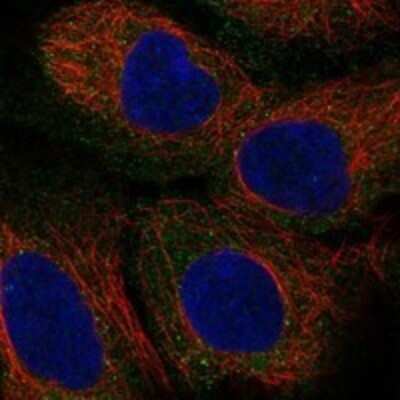 Immunocytochemistry/Immunofluorescence: Trophinin Antibody [NBP3-17449] - Staining of human cell line HEK 293 shows localization to vesicles.