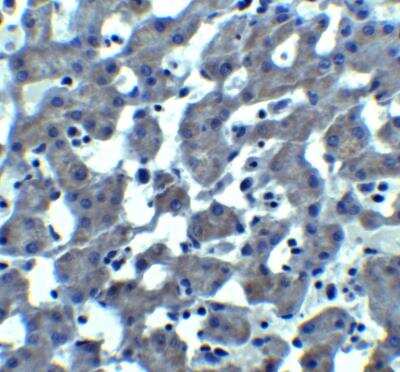 Immunohistochemistry: Trophinin Antibody [NBP2-41320] - Immunohistochemistry of TROPHININ in mouse liver tissue with TROPHININ antibody at 10 ug/ml.