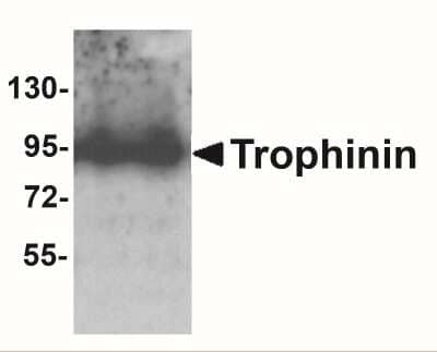 Western Blot: Trophinin Antibody [NBP2-41320] - Analysis of Trophinin in rat liver tissue lysate with Trophinin antibody at 1 ug/ml.