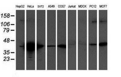 Western Blot: Tropomodulin 1 Antibody (2C2) [NBP2-00955] Analysis of extracts (35ug) from 9 different cell lines by using anti-Tropomodulin 1 monoclonal antibody.