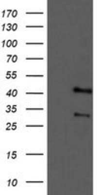 Western Blot: Tropomodulin 1 Antibody (OTI2C2) - Azide and BSA Free [NBP2-74632] - HEK293T cells were transfected with the pCMV6-ENTRY control (Left lane) or pCMV6-ENTRY Tropomodulin 1 (Right lane) cDNA for 48 hrs and lysed. Equivalent amounts of cell lysates (5 ug per lane) were separated by SDS-PAGE and immunoblotted with anti-Tropomo