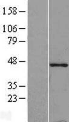 Western Blot: Tropomodulin 1 Overexpression Lysate (Adult Normal) [NBL1-17115] Left-Empty vector transfected control cell lysate (HEK293 cell lysate); Right -Over-expression Lysate for Tropomodulin 1.