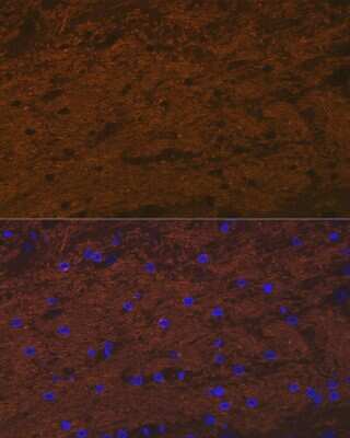 Immunocytochemistry/ Immunofluorescence Tropomodulin 2 Antibody (5E7G5)