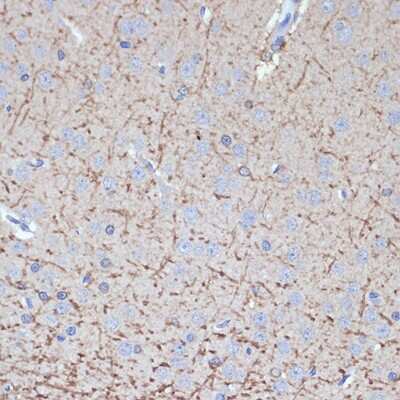 Immunohistochemistry-Paraffin Tropomodulin 2 Antibody (5E7G5)