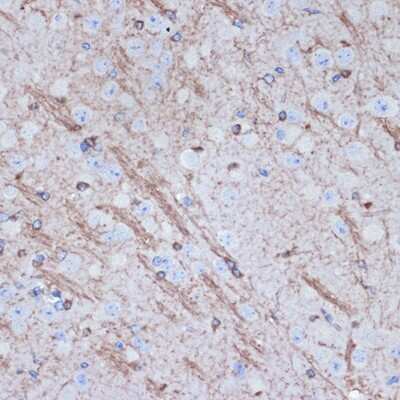 Immunohistochemistry-Paraffin Tropomodulin 2 Antibody (5E7G5)