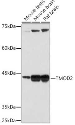 Western Blot: Tropomodulin 2 Antibody (5E7G5) [NBP3-15905] - Western blot analysis of extracts of various cell lines, using Tropomodulin 2 Rabbit mAb (NBP3-15905) at 1:1000 dilution. Secondary antibody: HRP Goat Anti-Rabbit IgG (H+L) at 1:10000 dilution. Lysates/proteins: 25ug per lane. Blocking buffer: 3% nonfat dry milk in TBST. Detection: ECL Basic Kit. Exposure time: 60s.