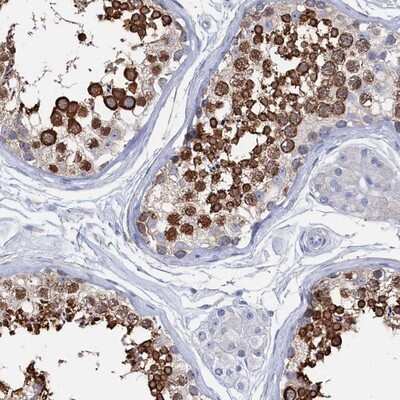 Immunohistochemistry-Paraffin: Tropomodulin 2 Antibody [NBP1-87378] - Staining of human testis shows strong cytoplasmic positivity in cells in seminiferus ducts.