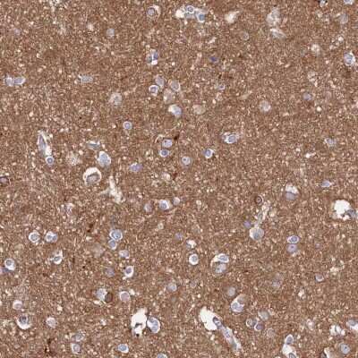 Immunohistochemistry-Paraffin Tropomodulin 2 Antibody