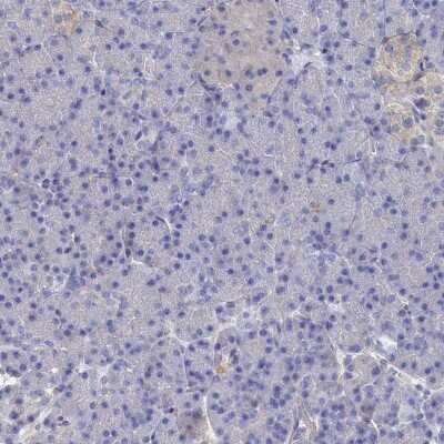 Immunohistochemistry-Paraffin Tropomodulin 2 Antibody