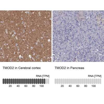 Immunohistochemistry-Paraffin: Tropomodulin 2 Antibody [NBP1-87378] - Staining in human cerebral cortex and pancreas tissues using anti-TMOD2 antibody. Corresponding TMOD2 RNA-seq data are presented for the same tissues.