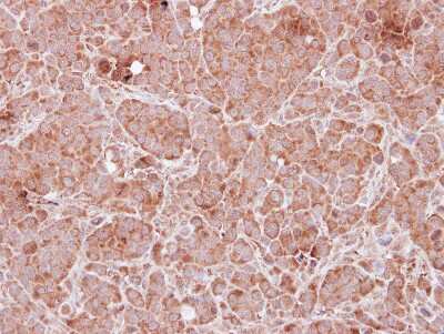 Immunohistochemistry-Paraffin: Tropomodulin 2 Antibody [NBP2-20730] - Immunohistochemical analysis of paraffin-embedded MDA-MB157 xenograft, using antibody at 1:250 dilution.