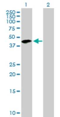 Western Blot: Tropomodulin 2 Antibody [H00029767-B01P] - Analysis of TMOD2 expression in transfected 293T cell line by TMOD2 polyclonal antibody.  Lane 1: TMOD2 transfected lysate(38.61 KDa). Lane 2: Non-transfected lysate.