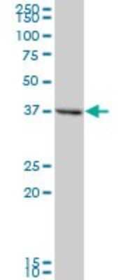 Western Blot: Tropomodulin 2 Antibody [H00029767-B02P] - Analysis of TMOD2 expression in rat brain.