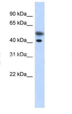 Western Blot: Tropomodulin 2 Antibody [NBP1-79572] - Transfected 293T cell lysate, concentration 0.2-1 ug/ml.