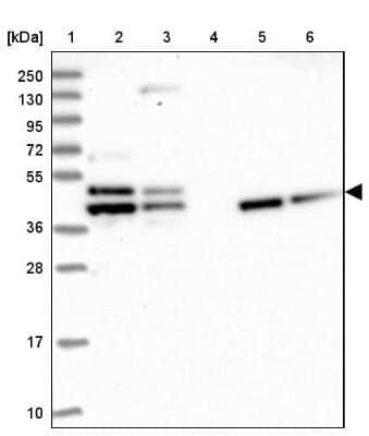 Western Blot: Tropomodulin 2 Antibody [NBP1-87378] - Lane 1: Marker [kDa] 250, 130, 95, 72, 55, 36, 28, 17, 10Lane 2: Human cell line RT-4Lane 3: Human cell line U-251MG spLane 4: Human plasma (IgG/HSA depleted)Lane 5: Human liver tissueLane 6: Human tonsil tissue