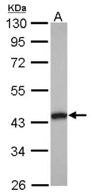 Western Blot: Tropomodulin 2 Antibody [NBP2-20729] - Sample (30 ug of whole cell lysate) A: IMR32 10% SDS PAGE gel, diluted at 1:1000.