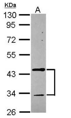 Western Blot: Tropomodulin 2 Antibody [NBP2-20730] - Sample (30 ug of whole cell lysate) A: MCF-710% SDS PAGE gel, diluted at 1:1000.