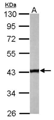 Western Blot: Tropomodulin 2 Antibody [NBP2-20730] - Sample (50 ug of whole cell lysate) A: Mouse Brain, 10% SDS PAGE gel, diluted at 1:1000.