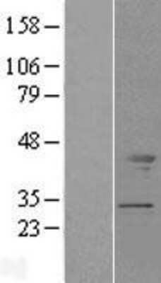 Western Blot: Tropomodulin 2 Overexpression Lysate (Adult Normal) [NBL1-17116] Left-Empty vector transfected control cell lysate (HEK293 cell lysate); Right -Over-expression Lysate for Tropomodulin 2.