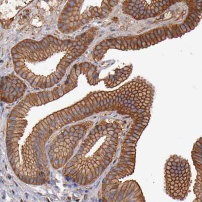 Immunohistochemistry-Paraffin Tropomodulin 3 Antibody