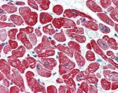 Immunohistochemistry-Paraffin: Tropomyosin-1 Antibody (CH1) [NBP1-40138] - Analysis of anti-Tropomyosin antibody with human heart at concentration 5 ug/ml.