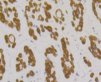 Immunohistochemistry-Paraffin: Tropomyosin-1 Antibody (JG38-66) [NBP2-75689] - Analysis of paraffin-embedded human heart tissue using anti-Tropomyosin 1 antibody. Counter stained with hematoxylin.