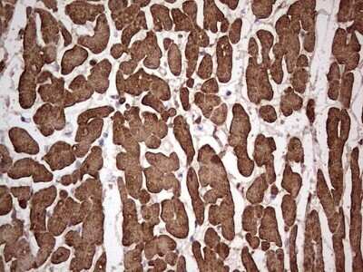 Immunohistochemistry: Troponin C (cardiac) Antibody (OTI5H3) - Azide and BSA Free [NBP2-74638] - Analysis of Human adult heart tissue. (Heat-induced epitope retrieval by 1 mM EDTA in 10mM Tris, pH8.5, 120C for 3min)