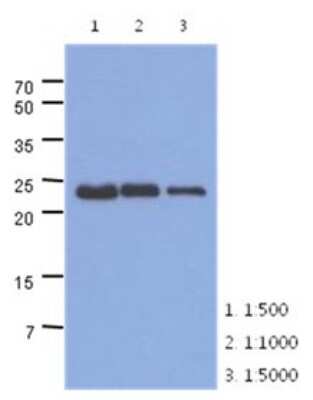 Western Blot: Troponin I Type 1 (slow skeletal) Antibody (36E7) [NBP2-22621] - The extracts of mouse muscle (40ug) were resolved by SDS-PAGE, transferred to PVDF membrane and probed with anti-human TNNI1 antibody (1:500 ~ 1:5000). Proteins were visualized using a goat anti-mouse secondary antibody conjugated to HRP and an ECL detection system.