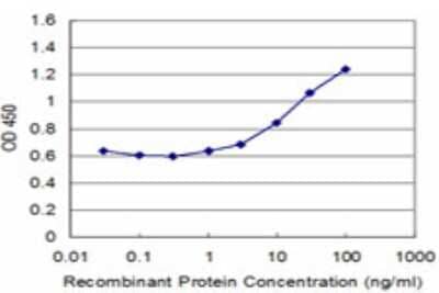 Sandwich ELISA: Troponin I Type 1 (slow skeletal) Antibody (4G6) [H00007135-M01] - Detection limit for recombinant GST tagged TNNI1 is approximately 1ng/ml as a capture antibody.