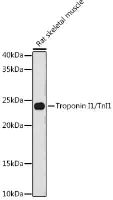 Western Blot: Troponin I Type 1 (slow skeletal) Antibody (5K1U2) [NBP3-16855] - Western blot analysis of extracts of Rat skeletal muscle cells, using Troponin I Type 1 (slow skeletal) antibody (NBP3-16855) at 1:1000 dilution. Secondary antibody: HRP Goat Anti-Rabbit IgG (H+L) at 1:10000 dilution. Lysates/proteins: 25ug per lane. Blocking buffer: 3% nonfat dry milk in TBST. Detection: ECL Basic Kit. Exposure time: 180s.